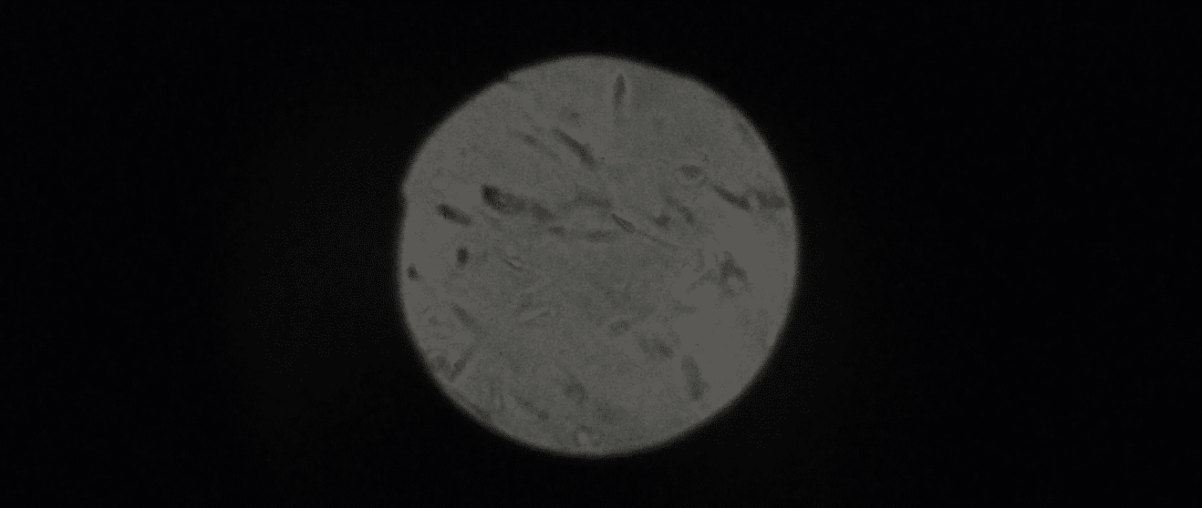 Two drops of the artists’ sperm dancing to Selena Gomez, seen by an audience through a microscope.
